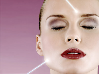 acne laser treatments