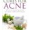 Natural cures for acne: How to cure acne using natural homemade